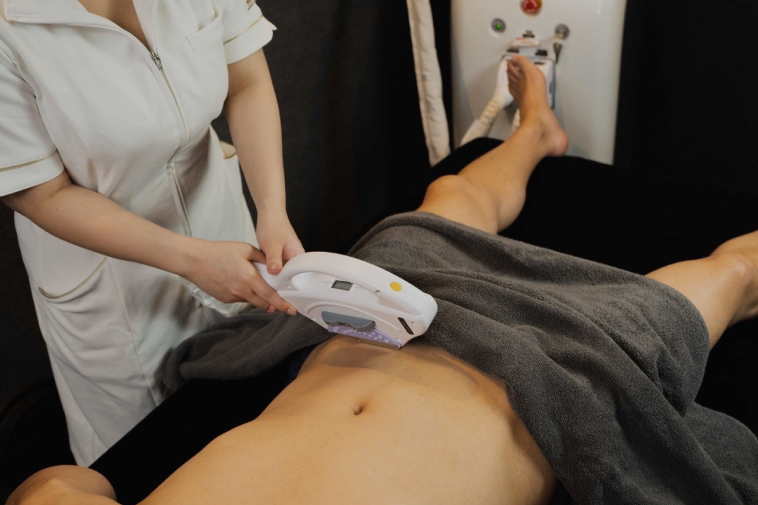 メンズ脱毛の施術写真